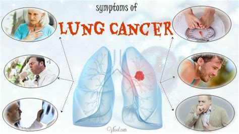 10 Early Symptoms Of Lung Cancer In Men And Women