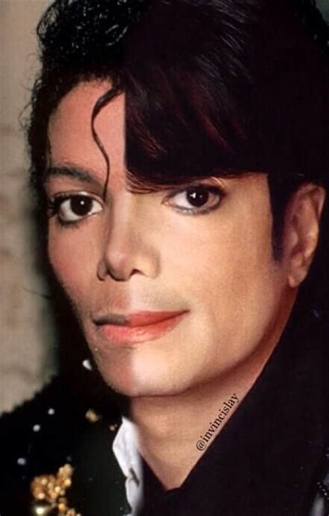 102 best Vitiligo & Michael Jackson. images on Pinterest ...