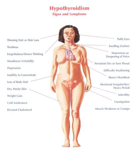 17 Best images about thyroid problems on Pinterest ...