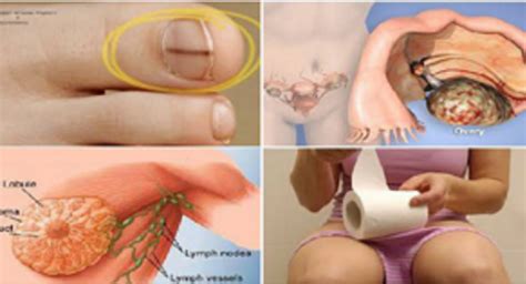 20 Deadly Cancer Symptoms Most Women Ignore   Healthy ...