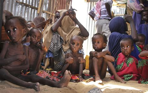 20 mil niños de Somalia corren el riesgo de morir por ...