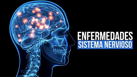 22 Enfermedades del sistema nervioso: Causas, Síntomas y ...