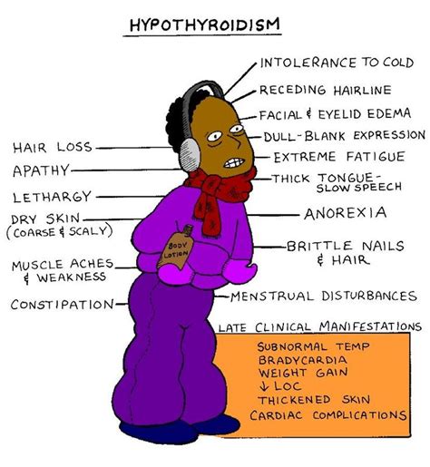 39 best images about Hypothyroidism on Pinterest ...