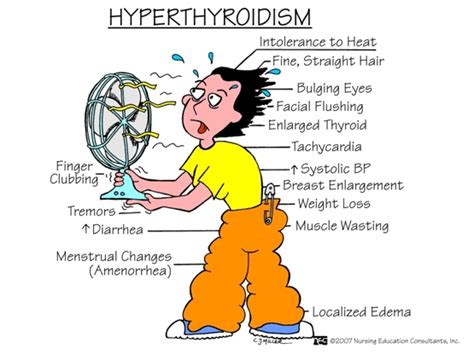 4 Natural remedies for hyperthyroidism