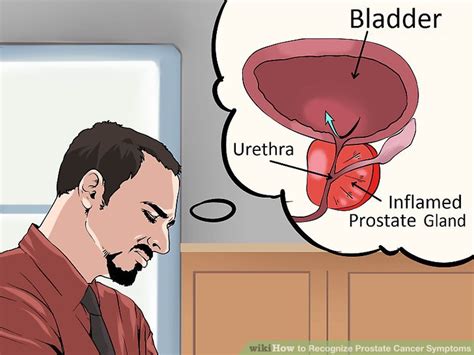 4 Ways to Recognize Prostate Cancer Symptoms   wikiHow