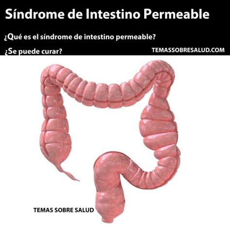 5 Causas del síndrome de intestino irritable y su relación ...