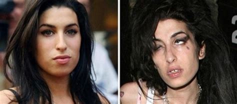6 celebridades antes e depois das drogas