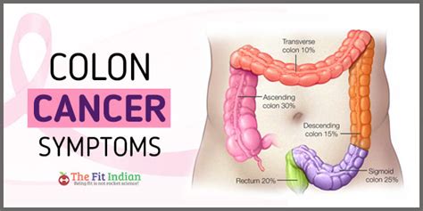 7 Dangerous Symptoms of Colon Cancer   Diagnosis and ...