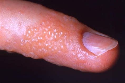 7 enfermedades que causan manchas rojas en la piel