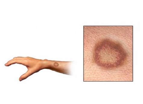 7 Tipos de enfermedades de la piel que no conocias