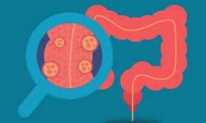 8 enfermedades del sistema digestivo