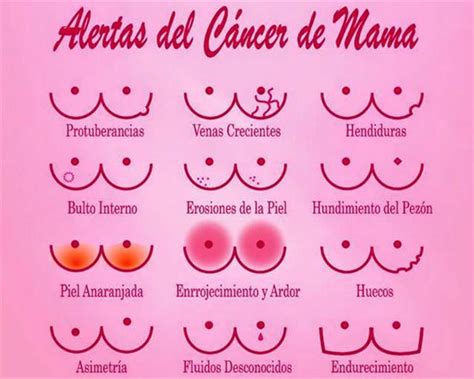 9 de cada 10 mujeres sobreviven al cáncer de mama gracias ...