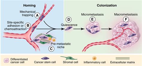 A Perspective on Cancer Cell Metastasis | Science