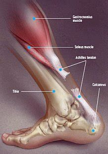 Achilles Tendon Rupture, Providing information and ...