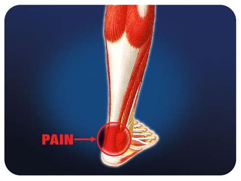 Achilles tendonitis | feetandpodiatry