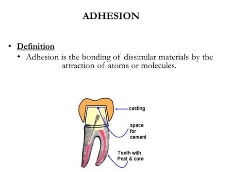 ADHESION IN RESTORATIVE DENTISTRY   ppt video online download