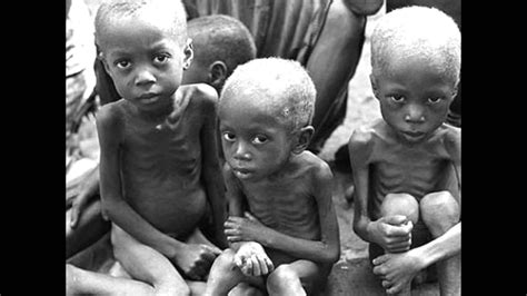 Africa Miséria e Pobreza   impossível não se emocionar ...
