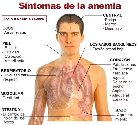 Algunos remedios naturales que ayudan en casos de anemia ...