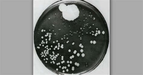 Almanac: The discovery of penicillin   CBS News