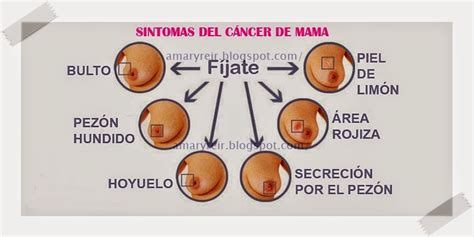 Amar Vivir Sentir y Sonreír ღ Blog: SINTOMAS DE CANCER ...