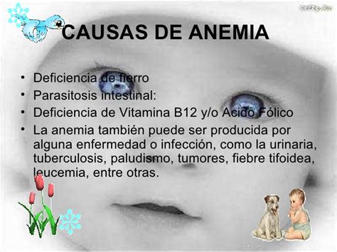 Anemia Pediatrica