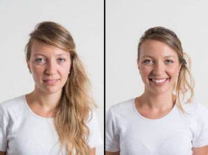 Antes y Después Fotos de la Radiofrecuencia Facial y ...