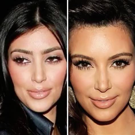 Antes y después Todas las operaciones de Kim Kardashian ...