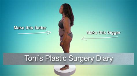 Atlanta Plastic   Toni s Plastic Surgery Diary   S1  E5 ...