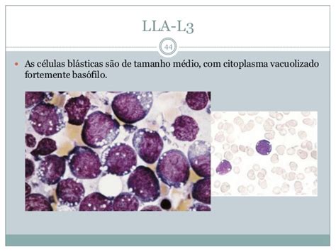Atlas de alterações e doenças hematológicas   Alberto Galdino