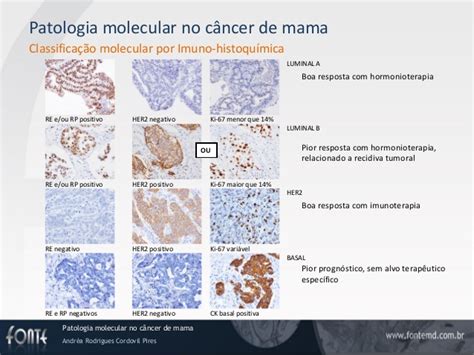 Aula: Mastologia mama patologia molecular
