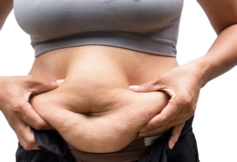 Avoid These 10 Foods To Lose Stomach Fat