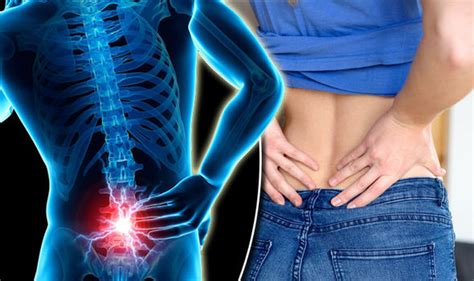 Back pain symptoms   signs a lower back condition could be ...
