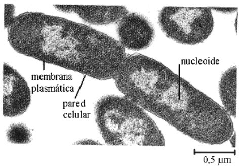 Bacteria a microscopio electrónico – El planeta de los ...