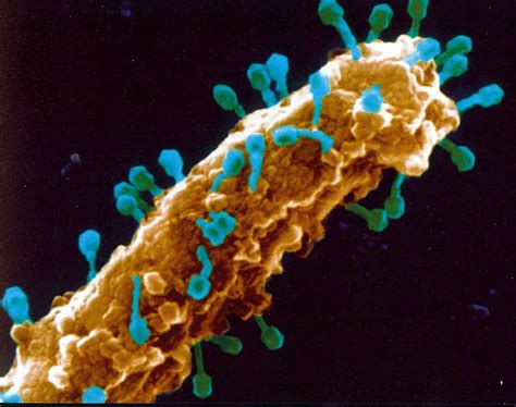Bacteriófagos T en E. coli visto con microscopio SEM ...