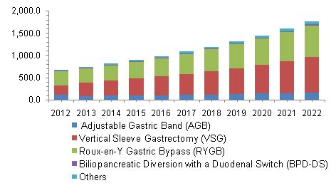 Bariatric Surgery Market Size, Share | Industry Report, 2022