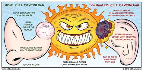 Basal Cell Carcinoma vs. Squamous Cell Carcinoma | Medcomic