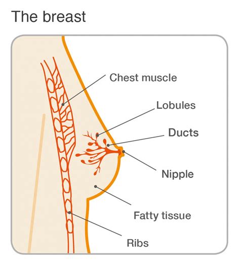 Benign breast conditions: fat necrosis