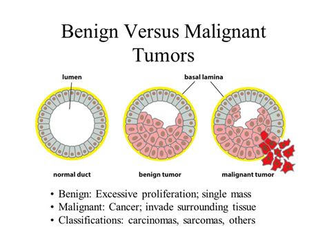 Benign Versus Malignant Tumors   ppt video online download