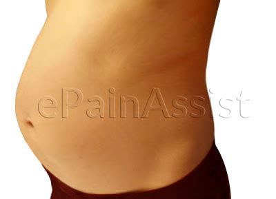 Bloated Stomach Causes Of Abdominal Distension And | Autos ...