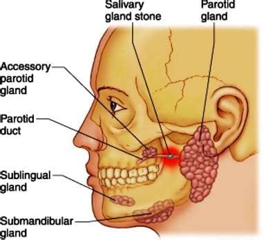 blocked salivary gland salivary stone image | health ...
