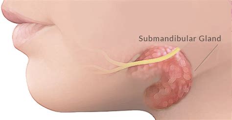 Brandon Hitchcock | Otolaryngologist | Submandibular Gland ...