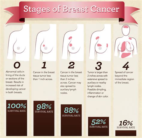 Breast Cancer Awareness | Stages of Breast Cancer ...