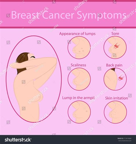 Breast Cancer Symptoms Vector Illustration Stock Vector ...
