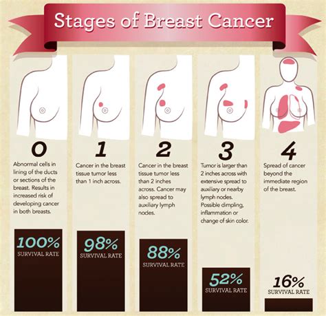 Breast Health at DePaul University   StudyBlue