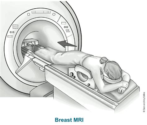 Breast MRI Scans