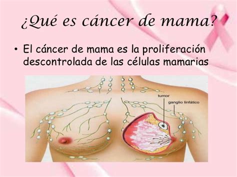 Campaña de salud de cancer de mama