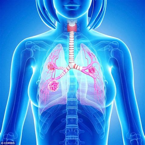 Cancer breakthrough as  master switch  that causes disease ...