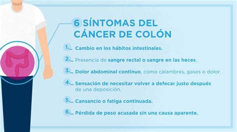 Cáncer de colón: Los seis síntomas que alertan de esta ...