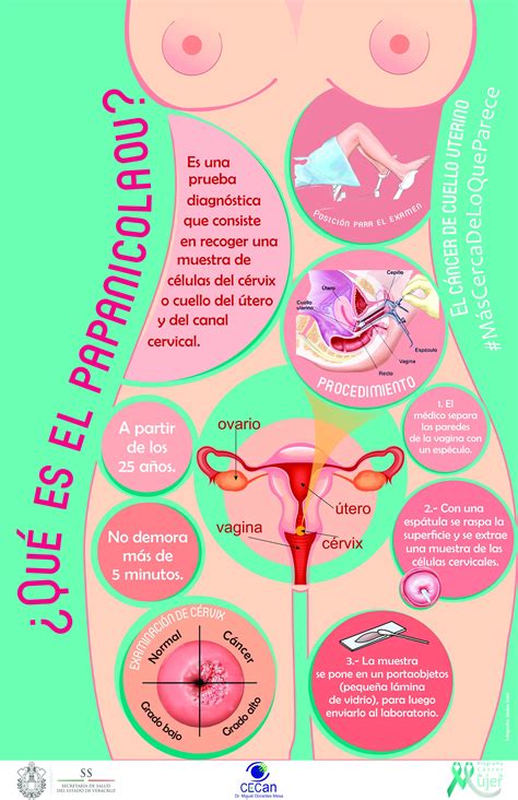 Cáncer de Cuello uterino