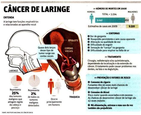 cáncer de faringe o laringe | faringe | Pinterest ...